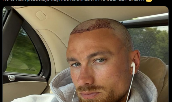 Matty Cash ZROBIŁ PRZESZCZEP WŁOSÓW! Tak teraz wygląda!